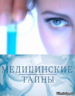 Медицинские тайны (2014)